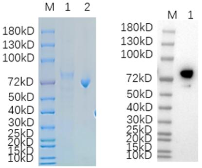 Reducing 12% SDS-PAGE (CBB stained) and WB (Anti-human IgG Goat antibody) analysis profiles of purified.